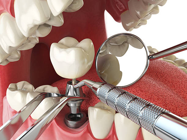 Best Pediatric Emergency Dentist in Bartonvle, IL